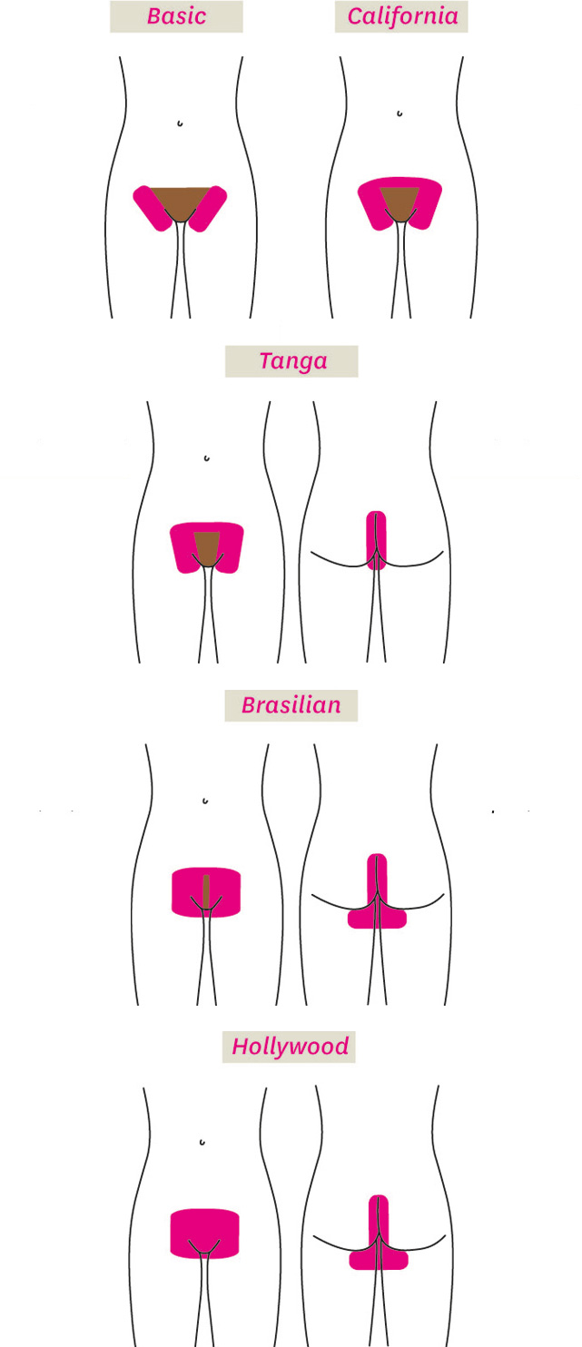lycon_bikini_depilacija_shema_web